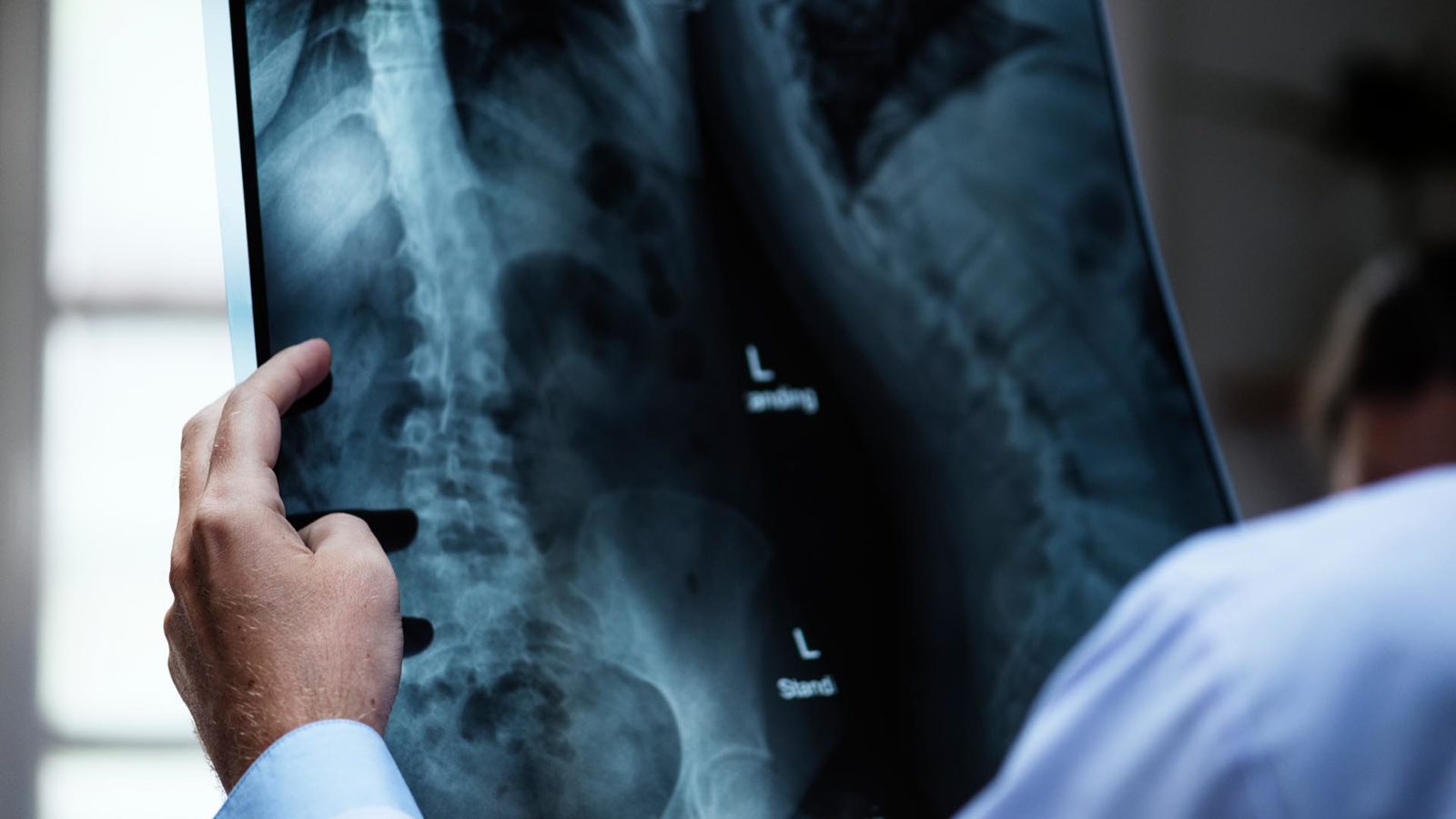 doctor looking at a spinal x-ray
